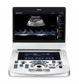 Ultrasonograf-aparat-usg-Acclarix-AX3-mobilny-Premium-EAN-GTIN-6944413811454.jpg